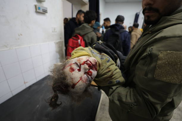 ޖަބާލިޔާގެ އަލް-ނަޒްލާ ގައި ހުރި ގެއަކަށް ބޮން އެޅުމުން ބޮޑެތި ޒަޚަމްތަކަކާއެކު މަރުވި ތުއްތު ކުއްޖެއްގެ ހަށިގަނޑު ހޮސްޕިޓަލަށް ގެންނަނީ