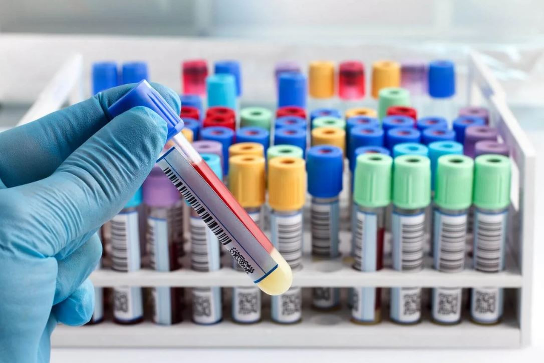 ބަލި ތަހުލީލް ކުރުމަށް ލޭނަގާ ޓިއުބް ތަކެއް