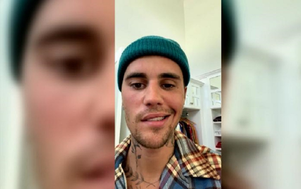 ޖަސްޓިން ބީބަރ، ޖެހުނު ބައްޔަކުން މޫނުގެ އެއްފަޅިން ވާގިނެތިފައި